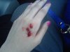 quadcopter-injury.jpg