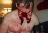 27477d1227909332-attempted-suicide-really-mangled-face-1227906745282-800x554.jpg